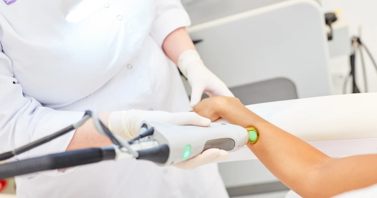 Epimia Lazer Epilasyon detay görseli